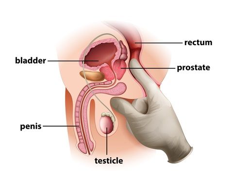 prostate milking