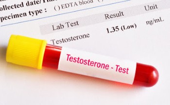 low testosterone in men